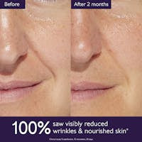 Age-Reversing Rich Cream: Clinical Results in 28 Days for Dry, Aging Skin