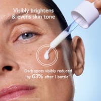 Radiant Glow Kit: Clinical Dark Spot Eraser for All Skin Tones
