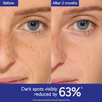 Radiant Glow Kit: Clinical Dark Spot Eraser for All Skin Tones