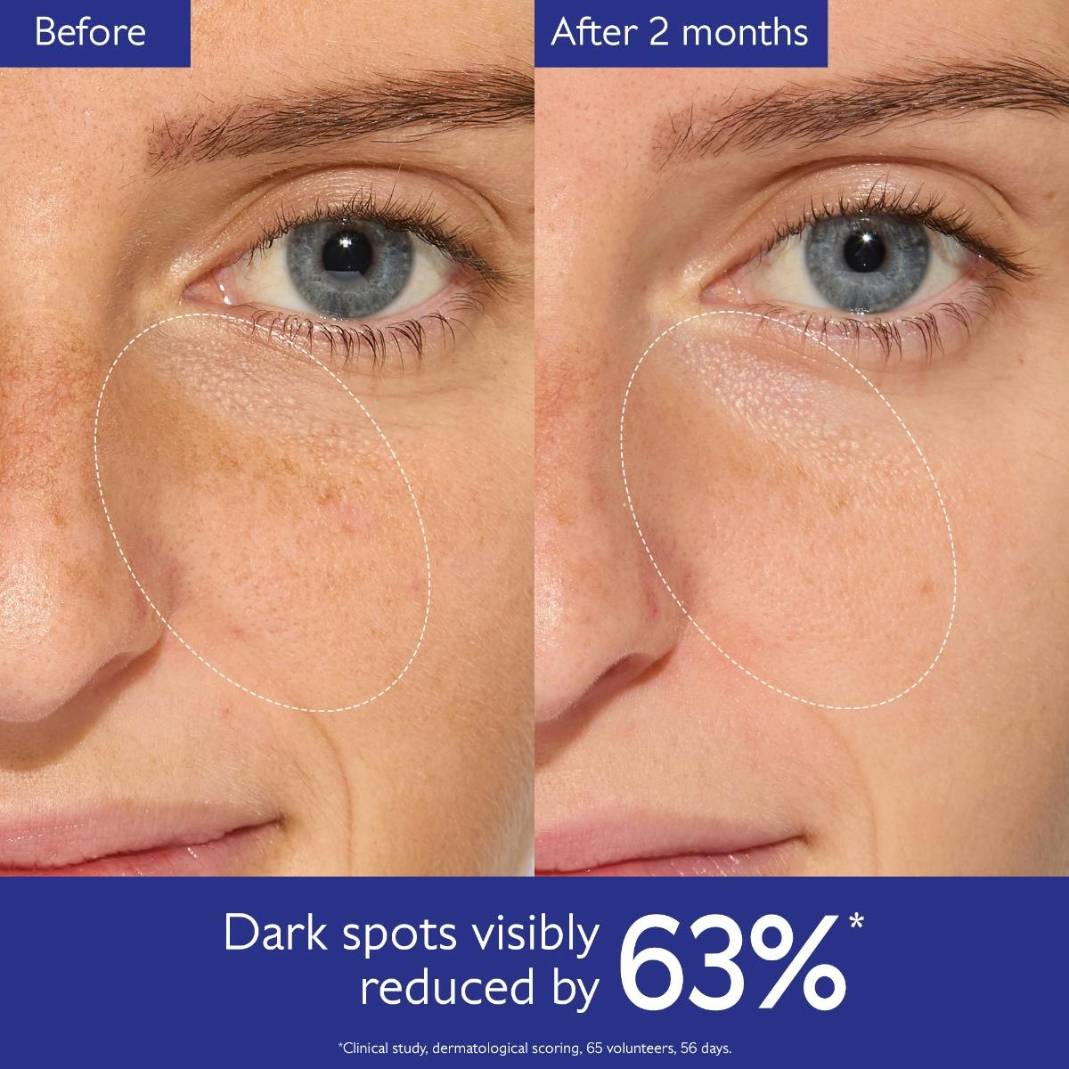 Radiant Glow Kit: Clinical Dark Spot Eraser for All Skin Tones